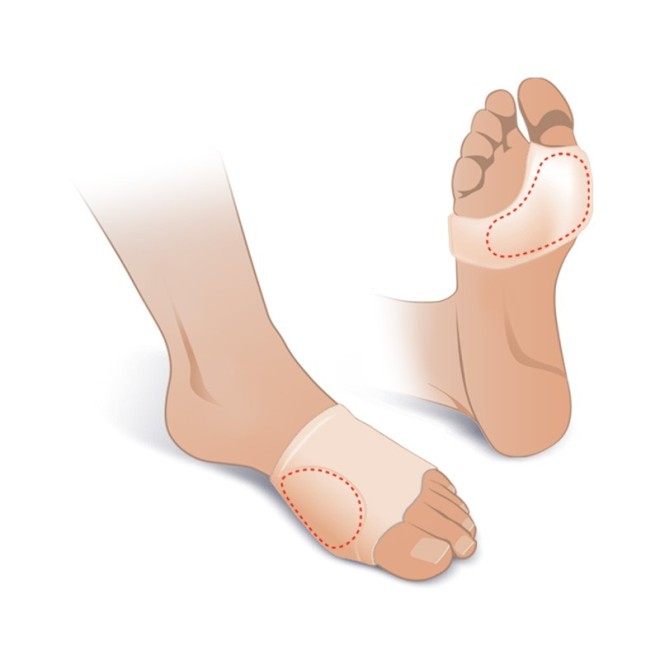 Guaina Plantare Alluce Valgo