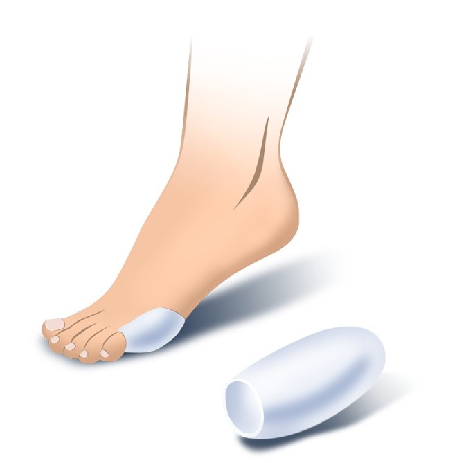 PROTETTORE MIGNOLO MISURA UNICA PZ. 1