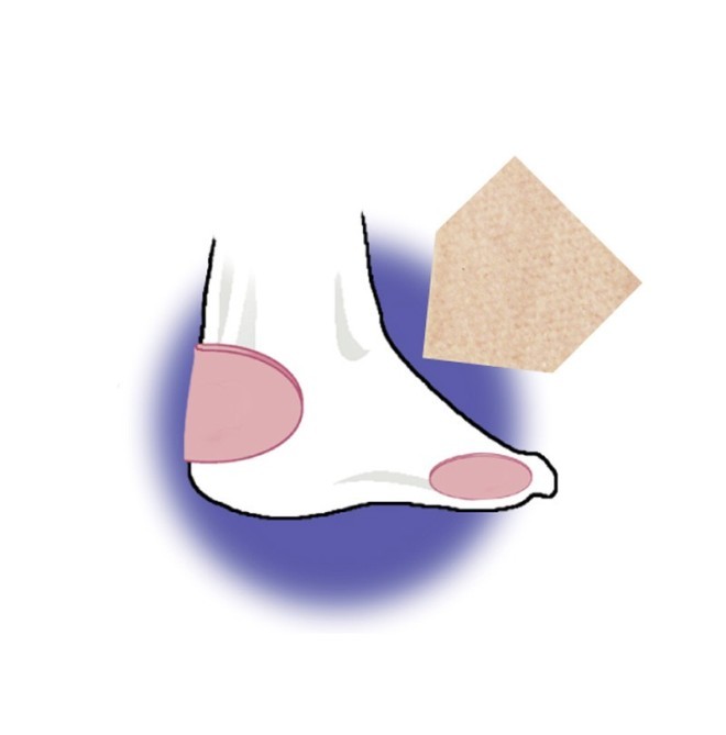 Feltro Speciale Molizann CM.10X7,5 PZ. 2 - Zanni Podospecial: Protezioni Personalizzate e Qualità Superiore