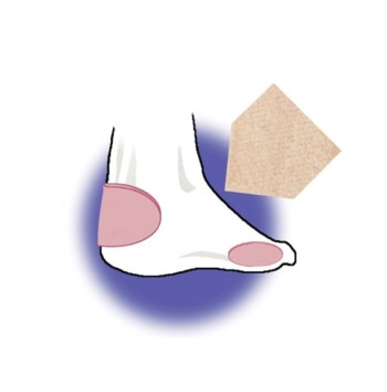 Feltro Speciale Molizann CM.10X7,5 PZ. 2 - Zanni Podospecial: Protezioni Personalizzate e Qualità Superiore