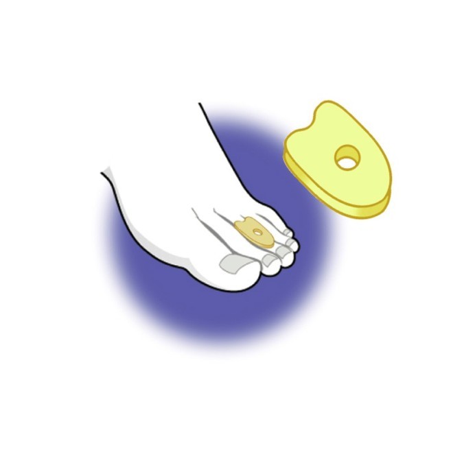 paracallo dita piedi