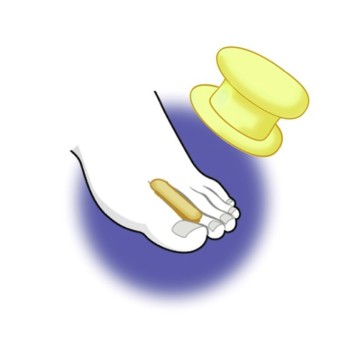 Raddrizz Alluce in Gomma