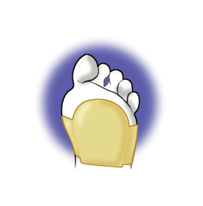 Met Luxe Cuscinetto Metatarsale