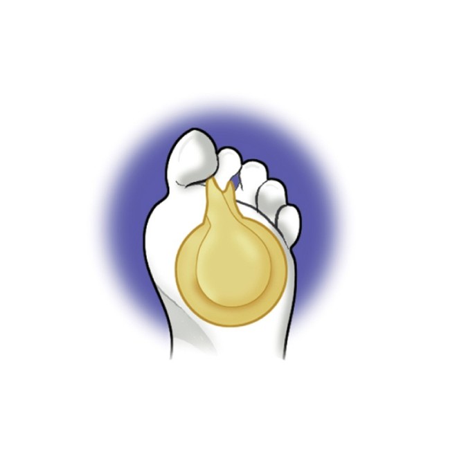 CUSCINETTO METATARSALE MISURA UNICA PA.1