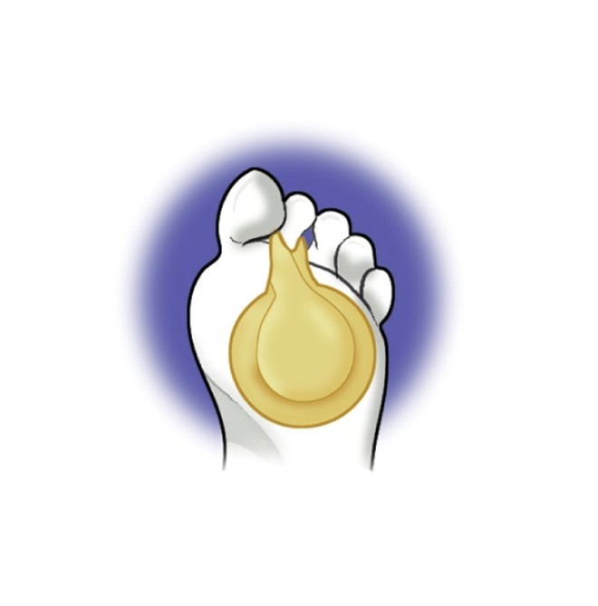 CUSCINETTO METATARSALE MISURA UNICA PA.1