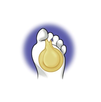 CUSCINETTO METATARSALE MISURA UNICA PA.1